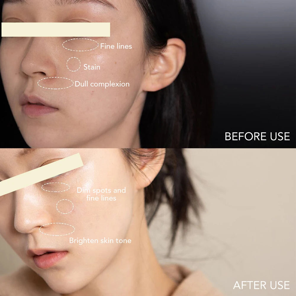 AILKE Dark Spot Corrector Facial Cream – Hydrating, SPF35+, Korean Skin Brightening & Anti-Sunburn