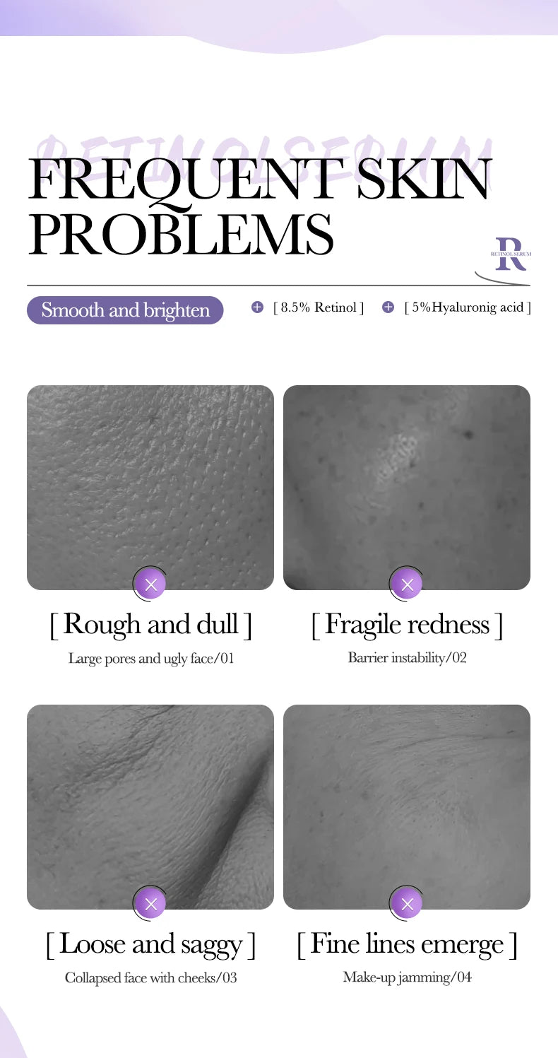 BIOAQUA Vitamin C Retinol Hyaluronic Acid Serum – Moisturizing, Brightening & Firming Facial Essence