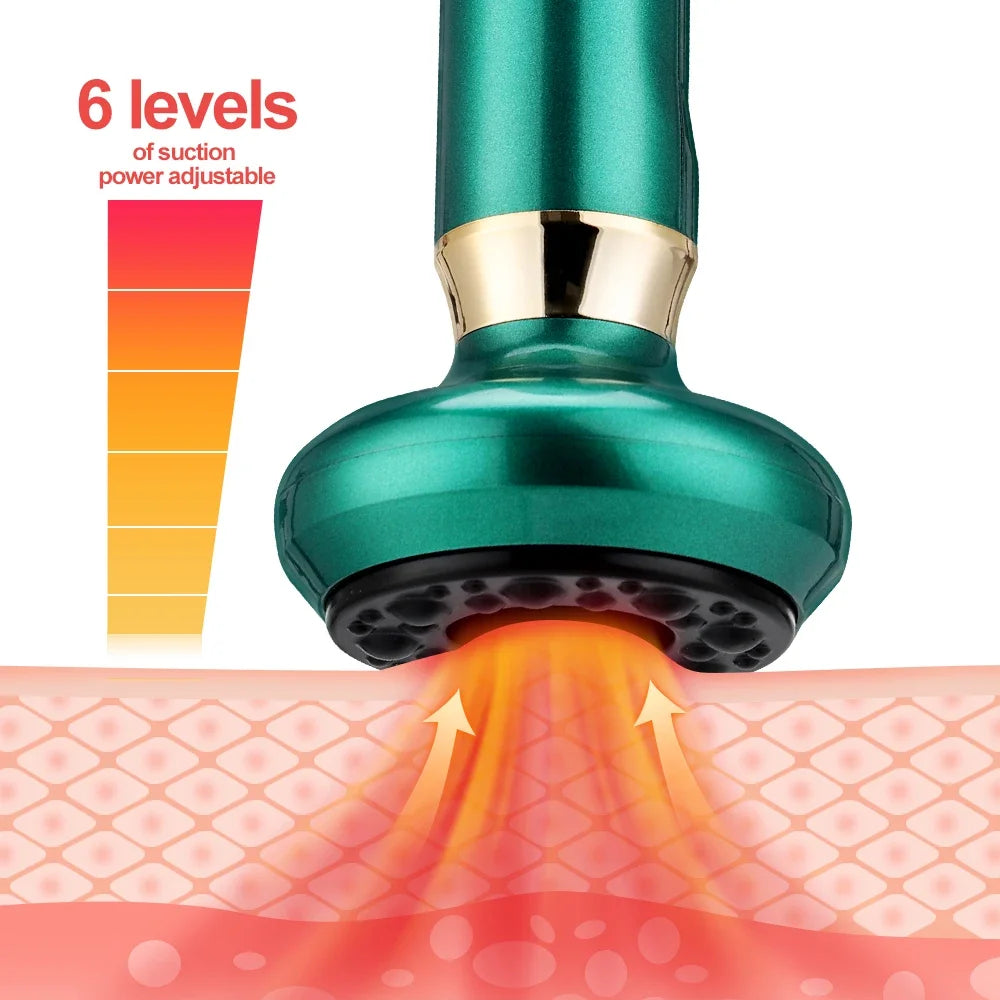 Electric Cupping Massager 6/12 Gear Vacuum Gua Sha Device – Anti-Cellulite Suction Heat Therapy Body Slimming Tool