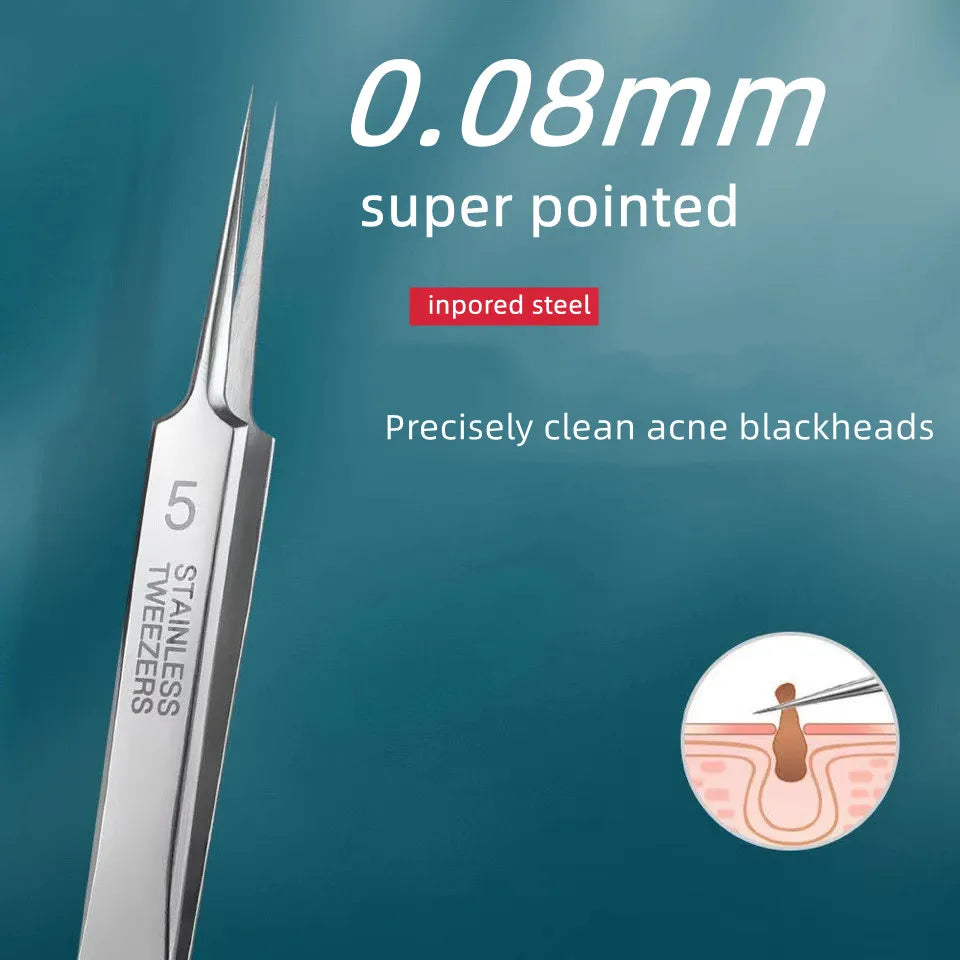 German Ultra-Fine No. 5 Blackhead Remover Tweezers – Precision Pimple Extractor, Acne Needle Tool for Face Care & Salon Use