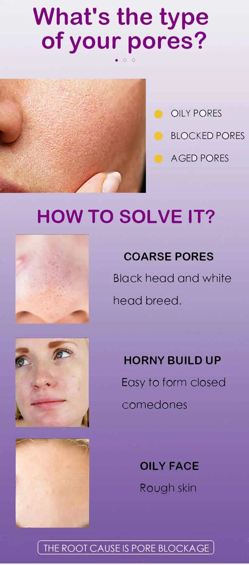 Pore Shrinking Serum – Facial Pore Minimizing & Tightening Essence for Smooth, Firm Skin