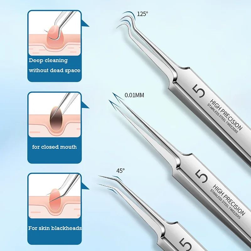 German Ultra-Fine No. 5 Blackhead Remover Tweezers – Precision Pimple Extractor, Acne Needle Tool for Face Care & Salon Use