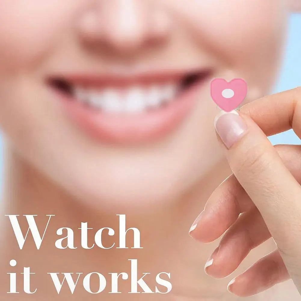 360pcs Invisible Pimple Patches – Anti-Acne Hydrocolloid Spot Stickers for Fast Healing