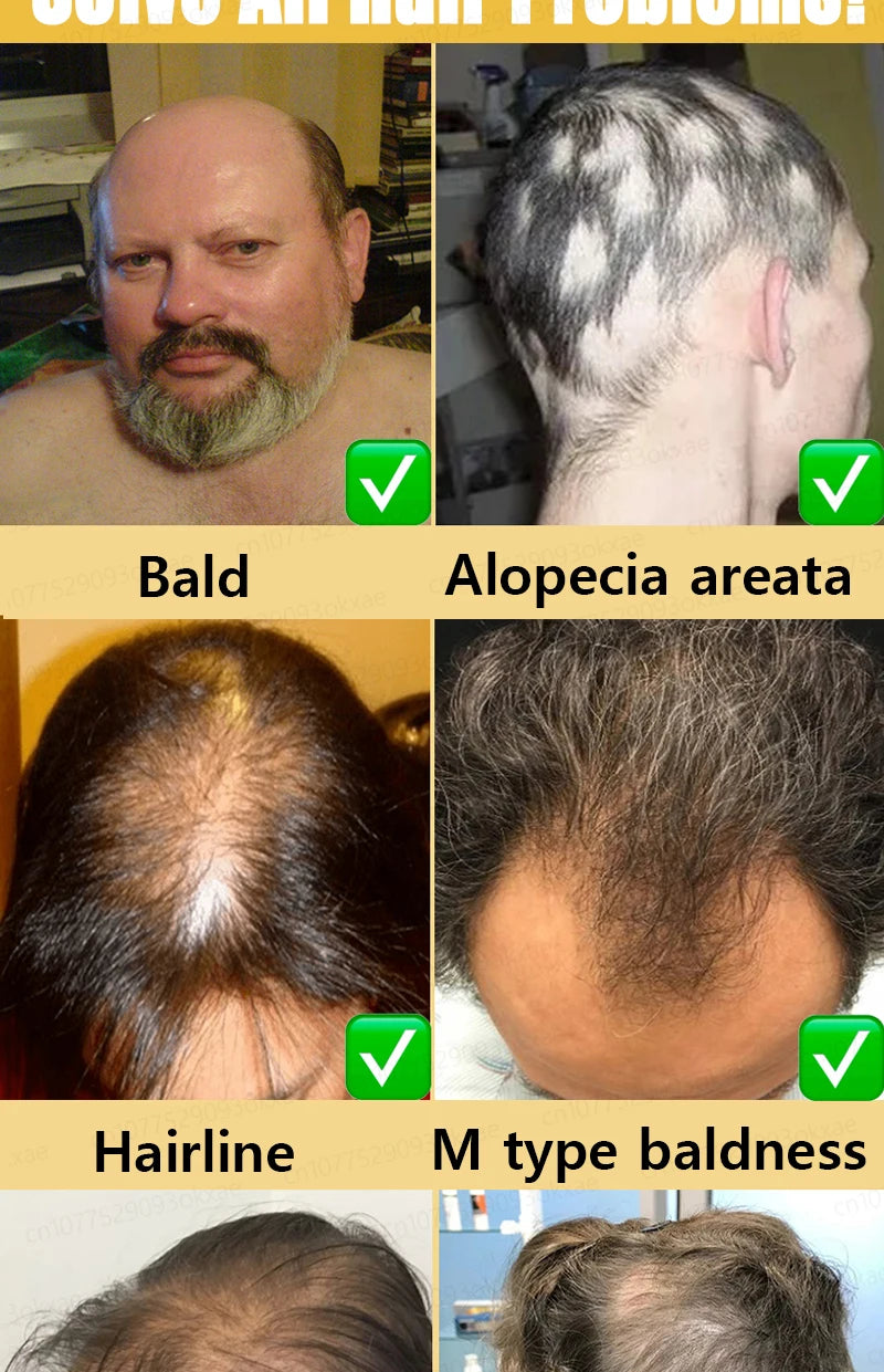 Hair growth essential oil, effectively repair baldness and hair loss, new hair growth