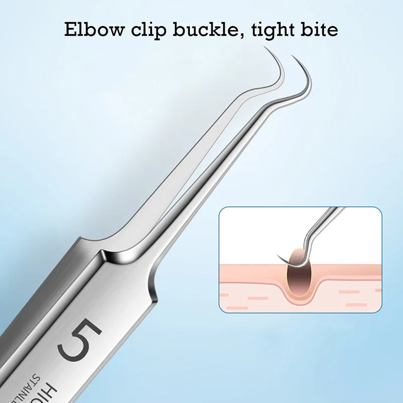 German Ultra-Fine No. 5 Blackhead Remover Tweezers – Precision Pimple Extractor, Acne Needle Tool for Face Care & Salon Use